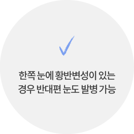 한쪽 눈에 황반변성이 있는 경우 반대편 눈도 발병 가능