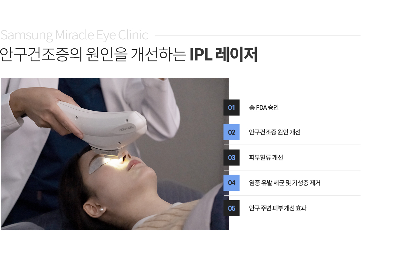 안구건조증의 원인을 개선하는 IPL 레이저