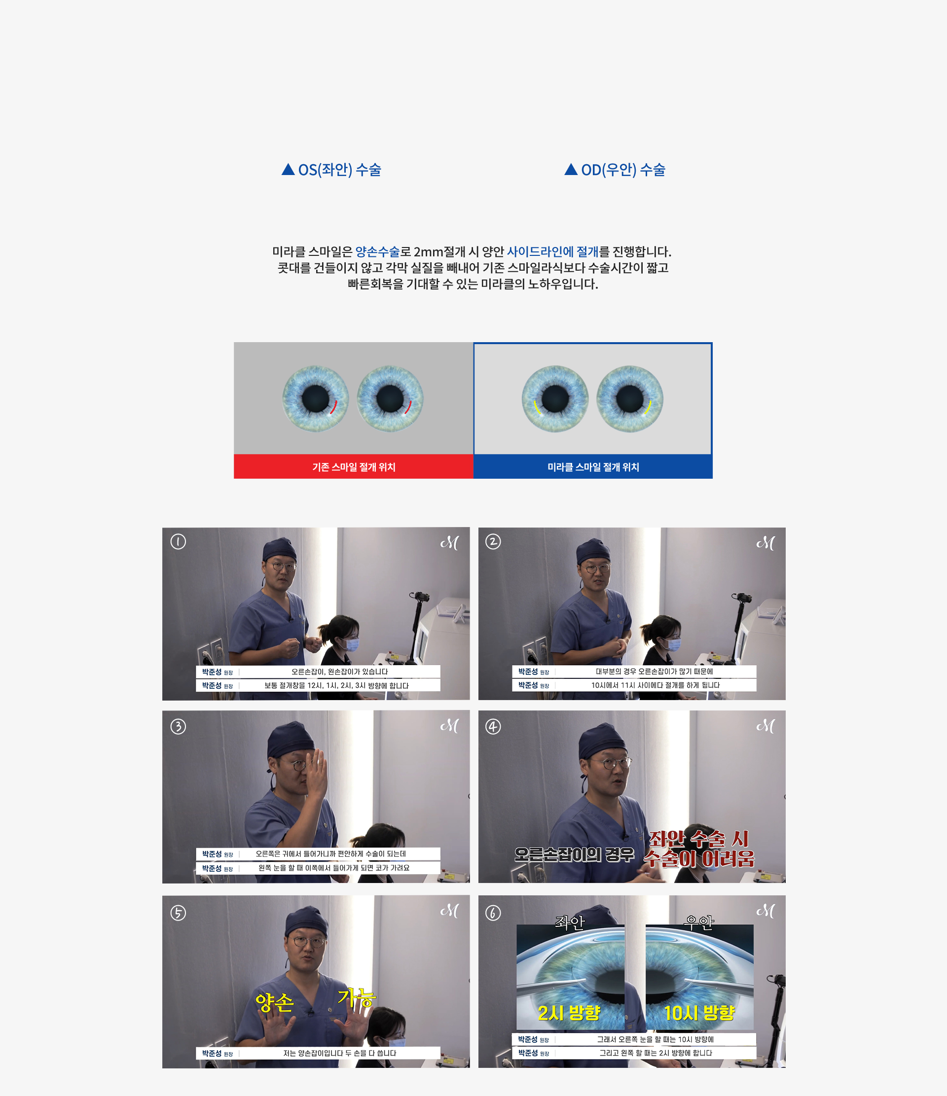 smileLasik 상세02