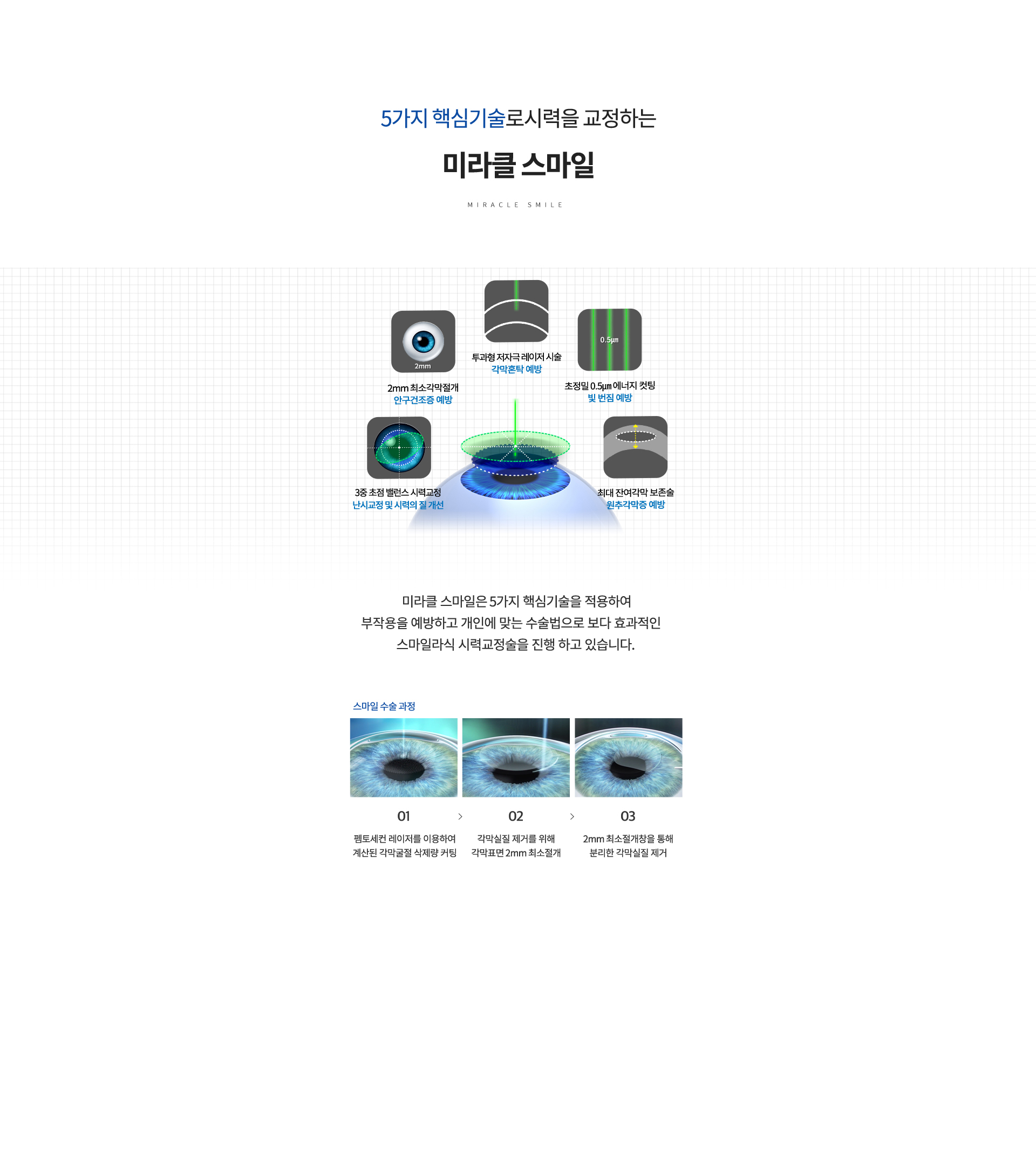 smileLasik 상세04