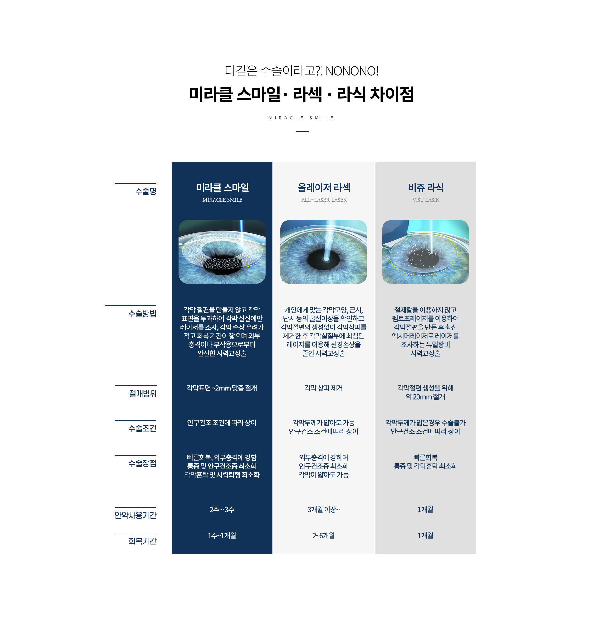 smileLasik 상세05