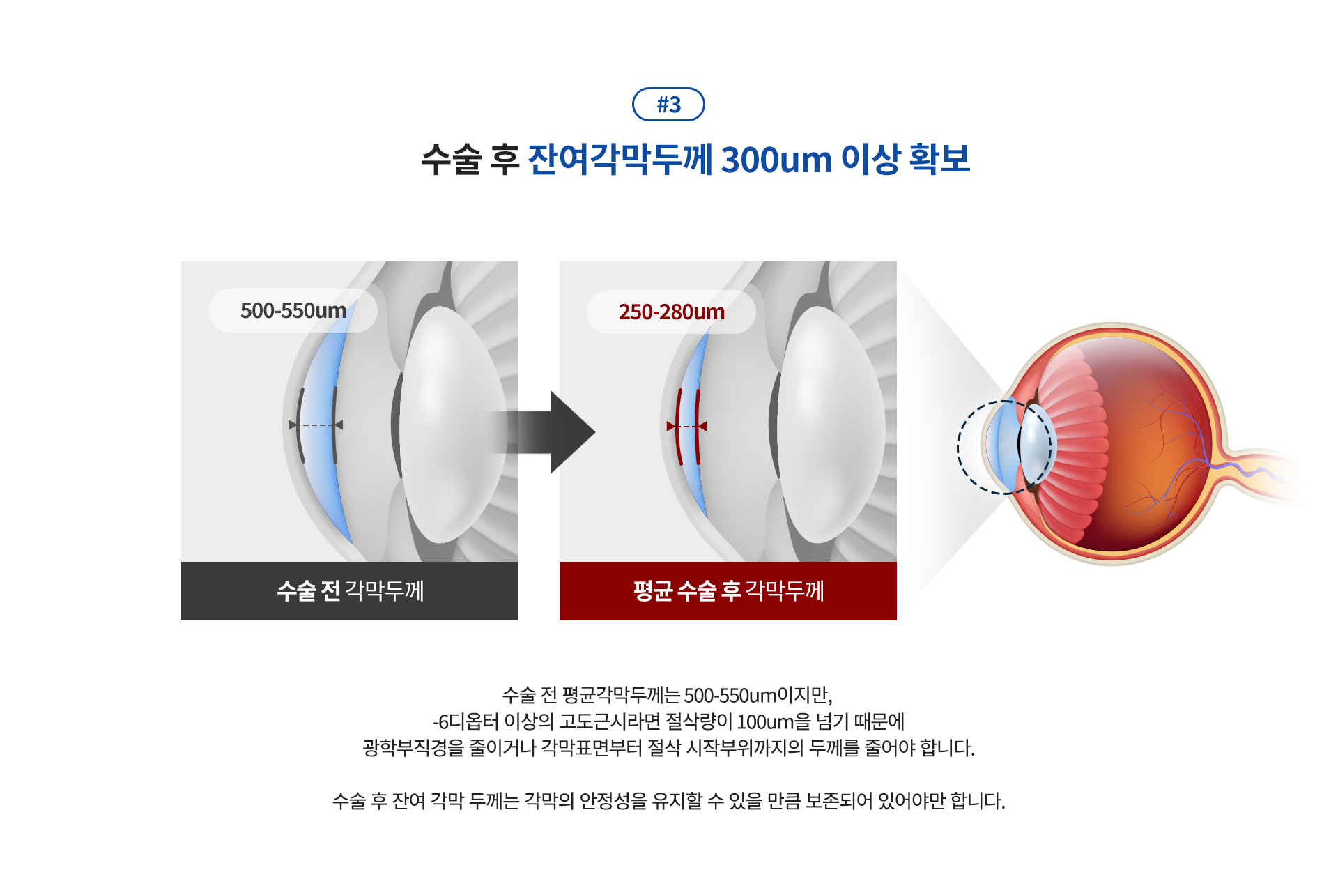 smilePromise 약속3_상세01