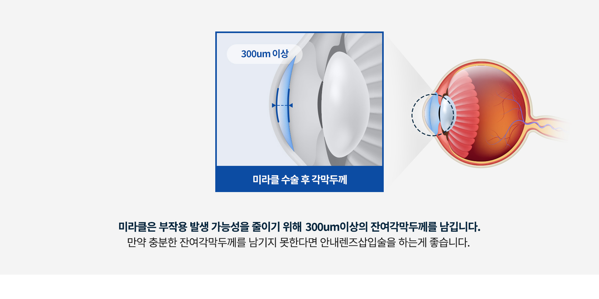 smilePromise 약속3_상세02