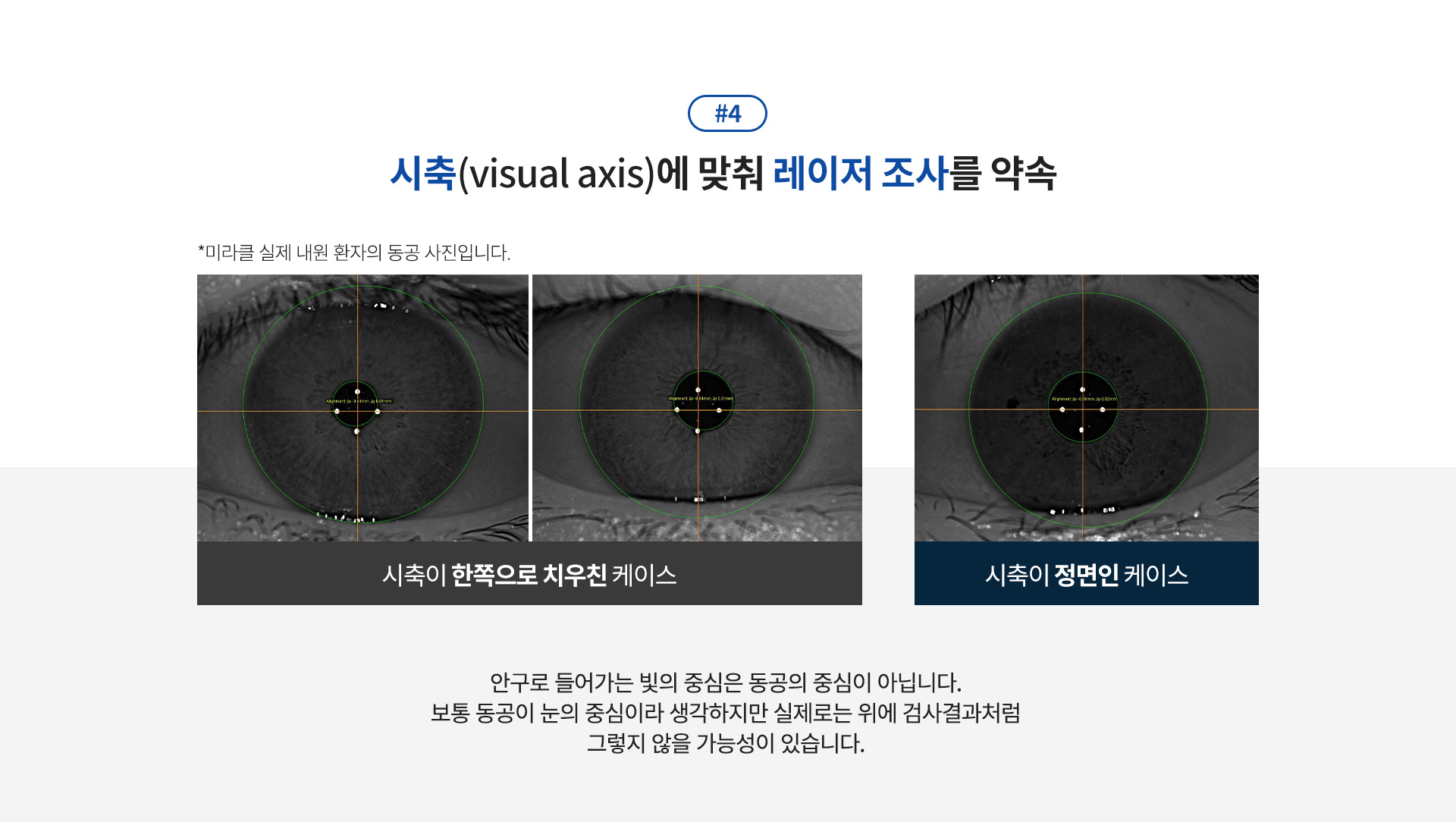 smilePromise 약속4_상세01