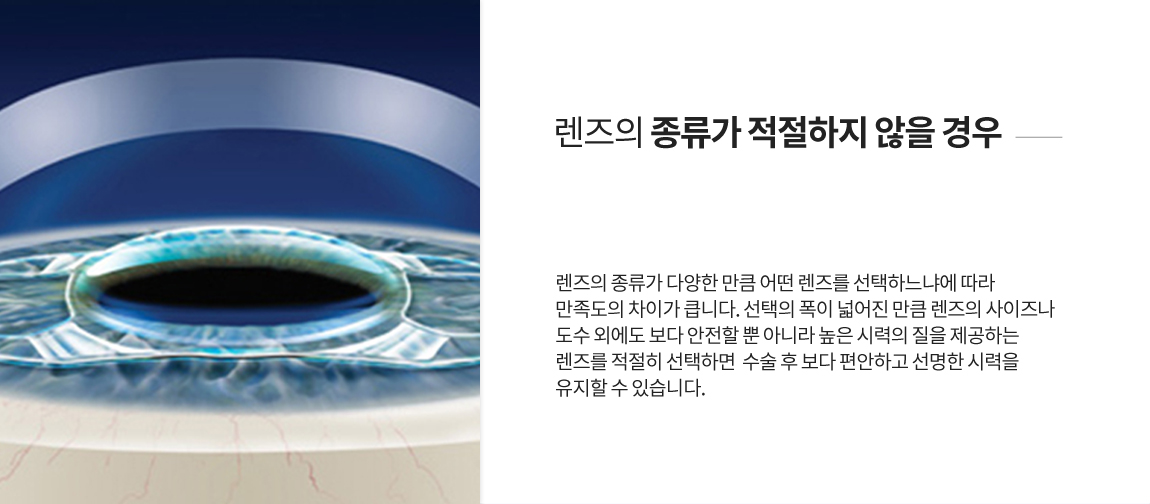 implant 상세06_04